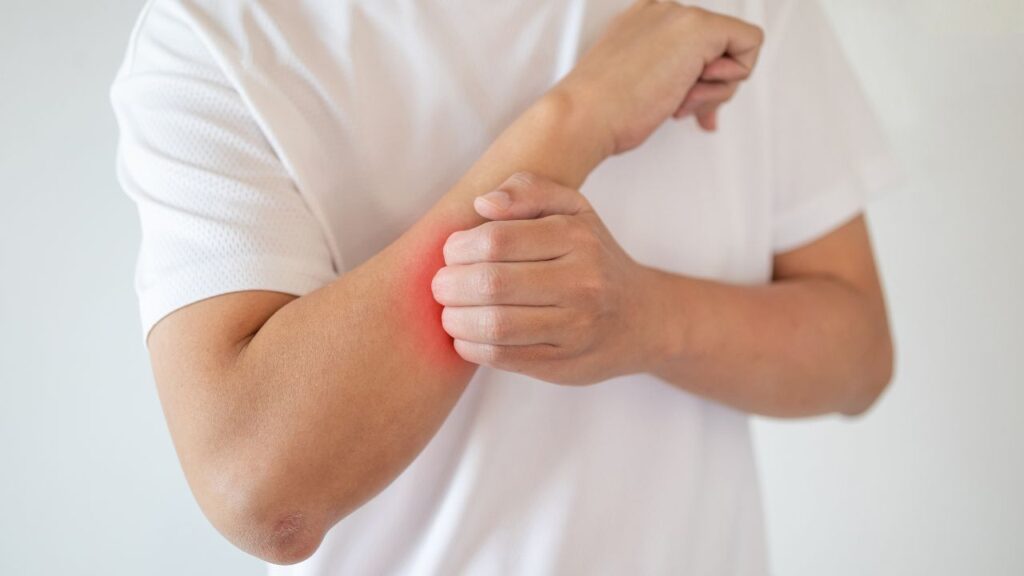 Side Effects of Niacin