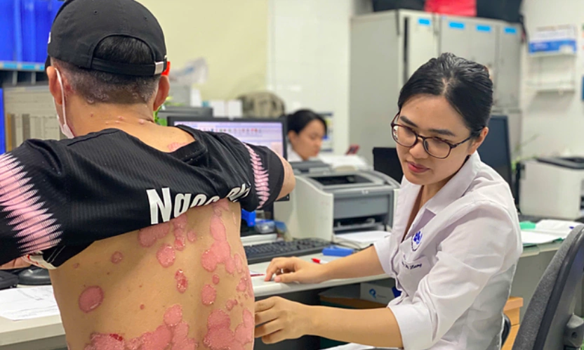 Bệnh nhân khám vảy nến tại Bệnh viện Da liễu Trung ương